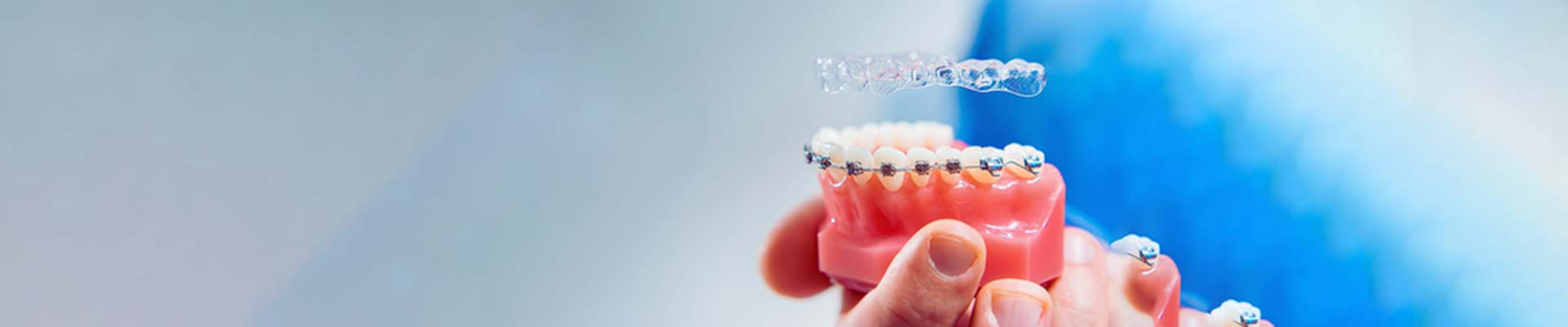Braces Invisalign Banner